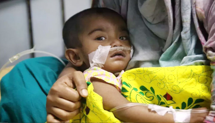 হাম ও হামের উপসর্গ নিয়ে আরও ১২ শিশুর মৃত্যু, আক্রান্ত ১৩০৩