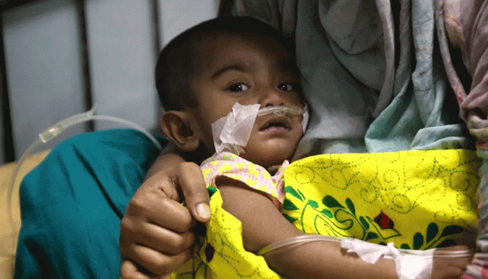 হাম ও হামের উপসর্গ নিয়ে আরও ১৩ শিশুর মৃত্যু, আক্রান্ত ২১৩২