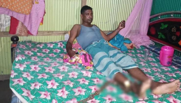​নোয়াখালীতে পাওনা টাকা আদায়ে অটোরিকশা চালককে শিকলে বেঁধে নির্যাতন