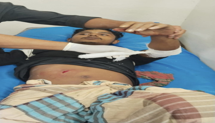 পিরোজপুরের জিয়ানগরে ফ্রী ফায়ার খেলাকে কেন্দ্র করে ছুরিকাঘাতে যুবক গুরুতর আহত